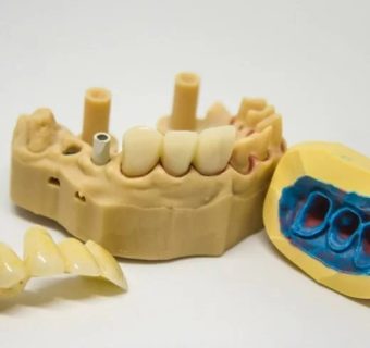 Microscopic endodontics — original treatment illustration