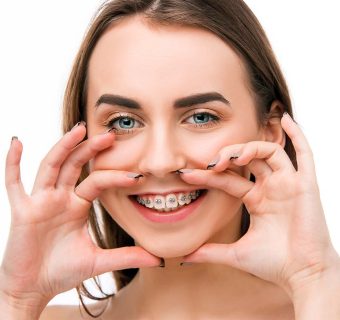 Smile makeovers — original treatment illustration