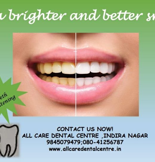 Dental braces — original treatment illustration