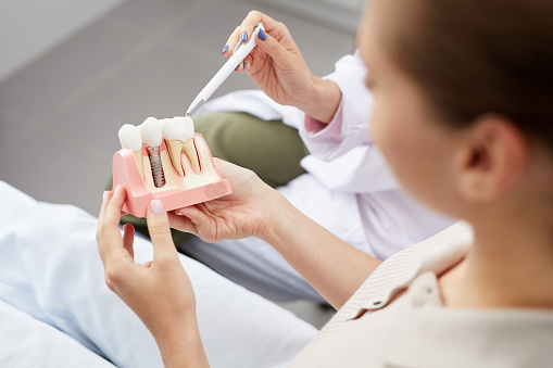 Choosing a replacement after tooth loss — original treatment illustration