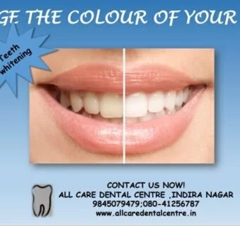 Teeth whitening — original treatment illustration