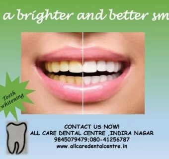 Teeth whitening — original treatment illustration