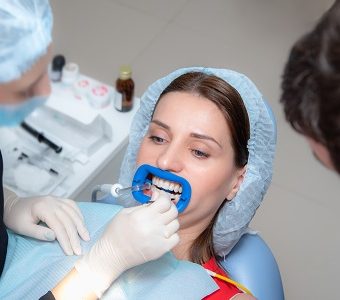Dental bonding — original treatment illustration