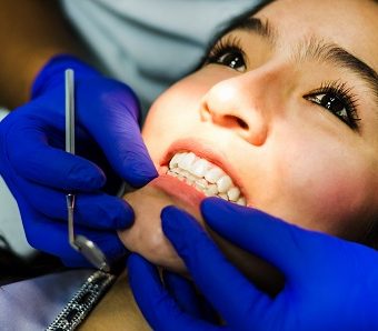 Smile makeovers — original treatment illustration
