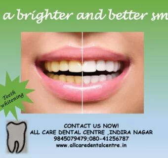 Clear dental aligners — original treatment illustration