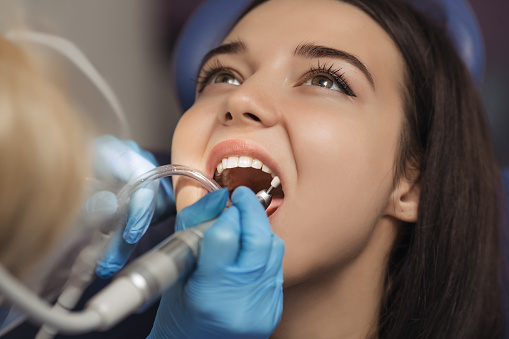 Teeth polishing and surface stains — original treatment illustration