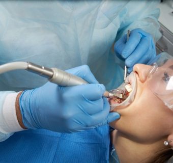 Wisdom tooth removal — original treatment illustration