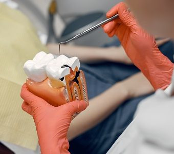 Rotary endodontics — original treatment illustration
