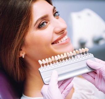 Dental veneers — original treatment illustration