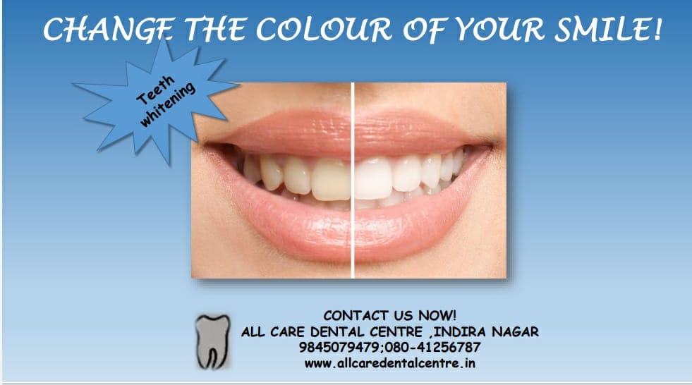 Original whitening campaign