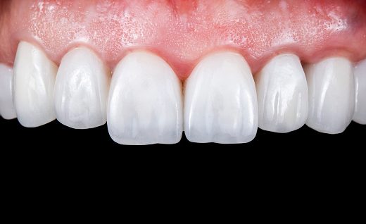 Endodontic consultation — original treatment illustration