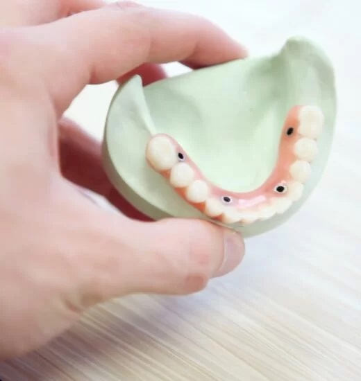Enamel shaping — original treatment illustration