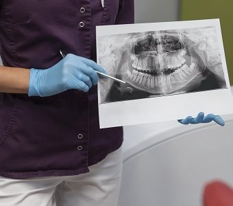 Dental imaging & radiology — original treatment illustration