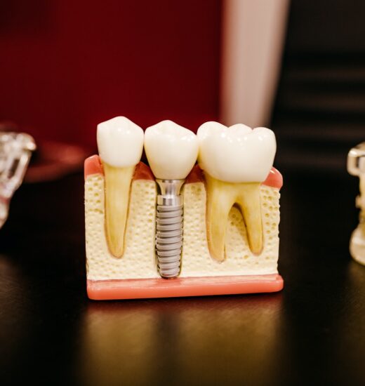 Endodontic consultation — original treatment illustration